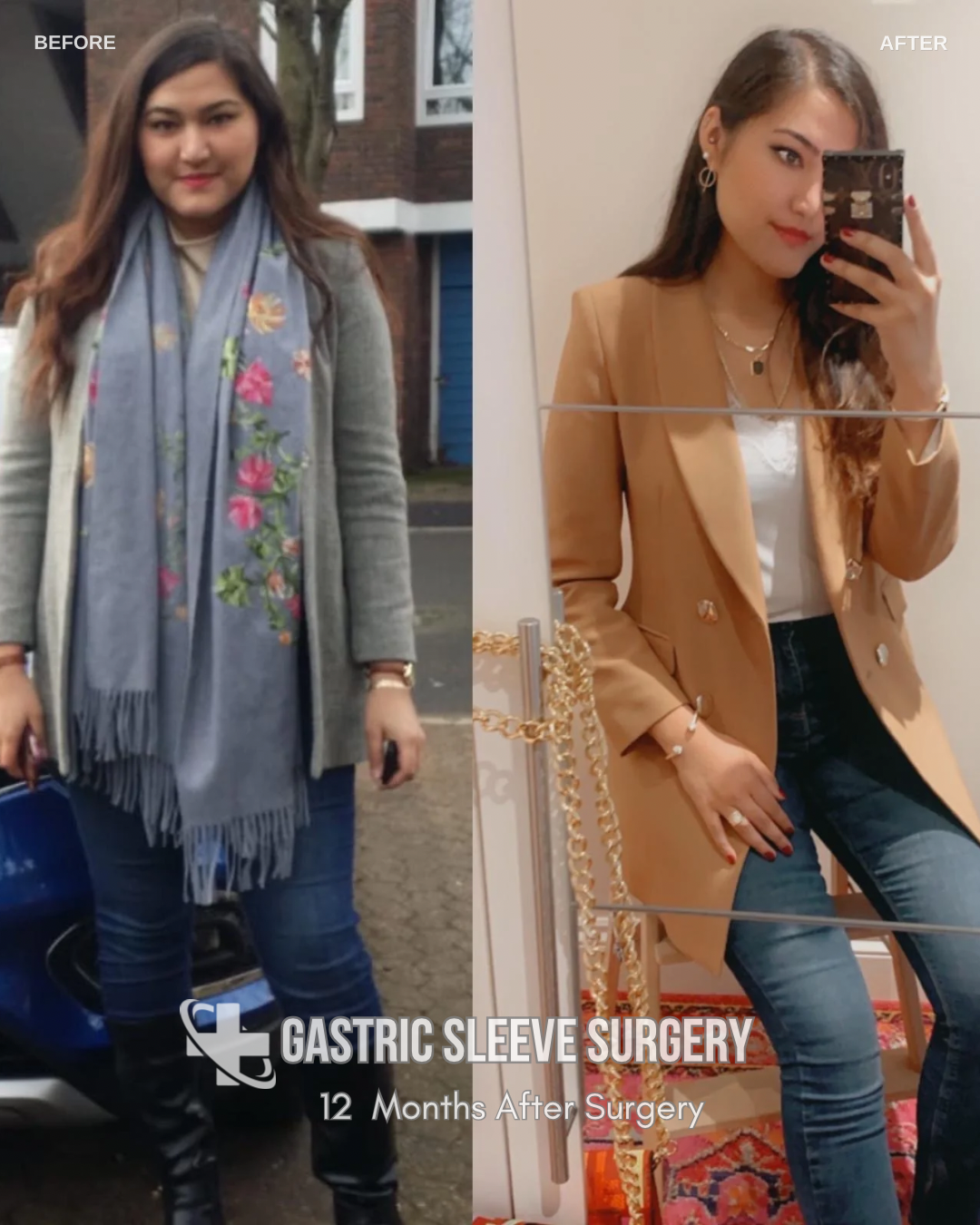 Lost 40 Kg