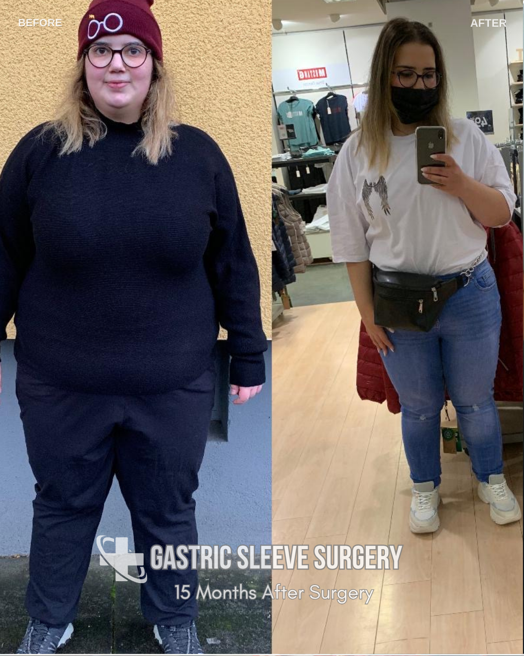 Lost 46 Kg